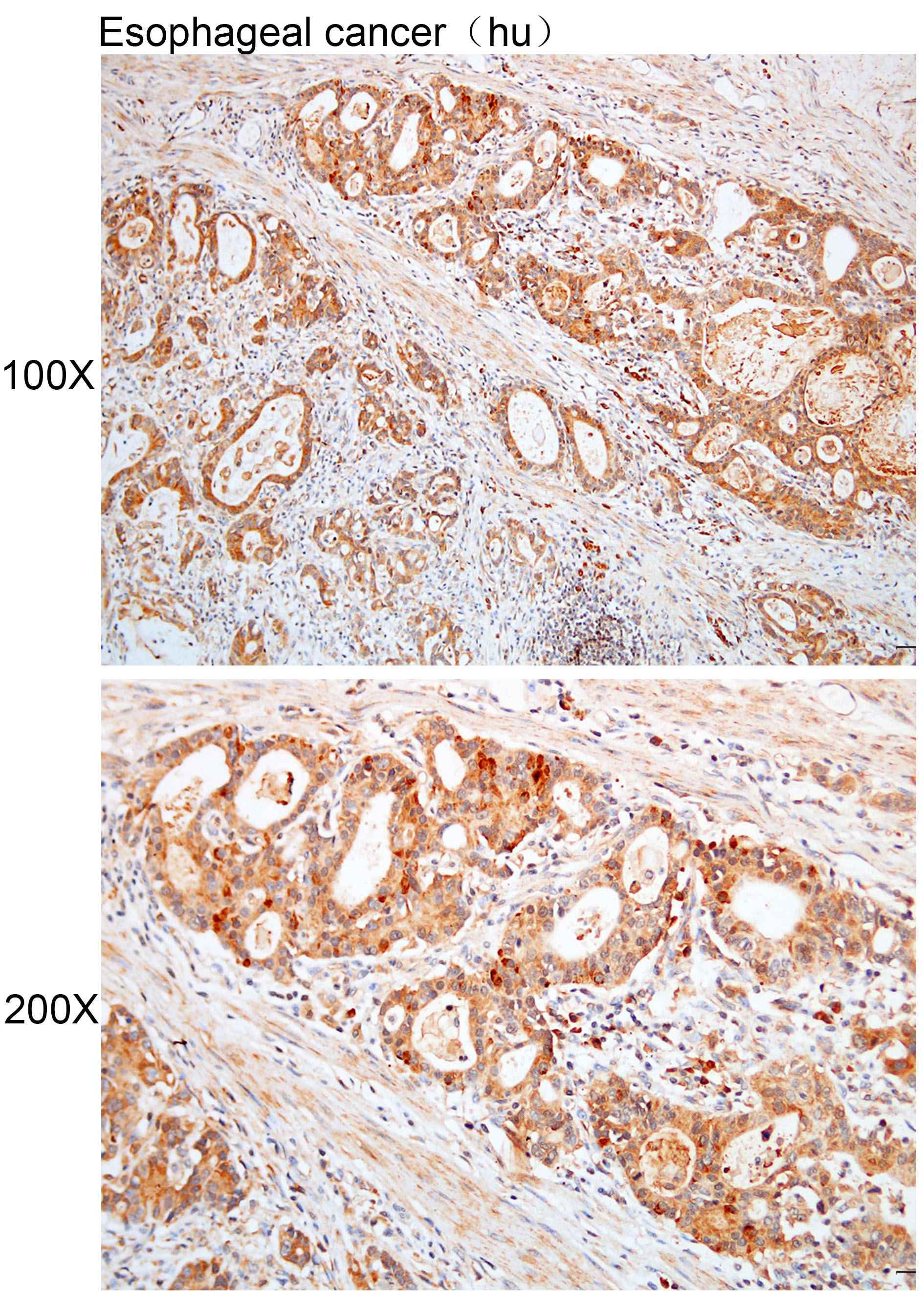 Anti-CCDC181 Polyclonal Antibo
