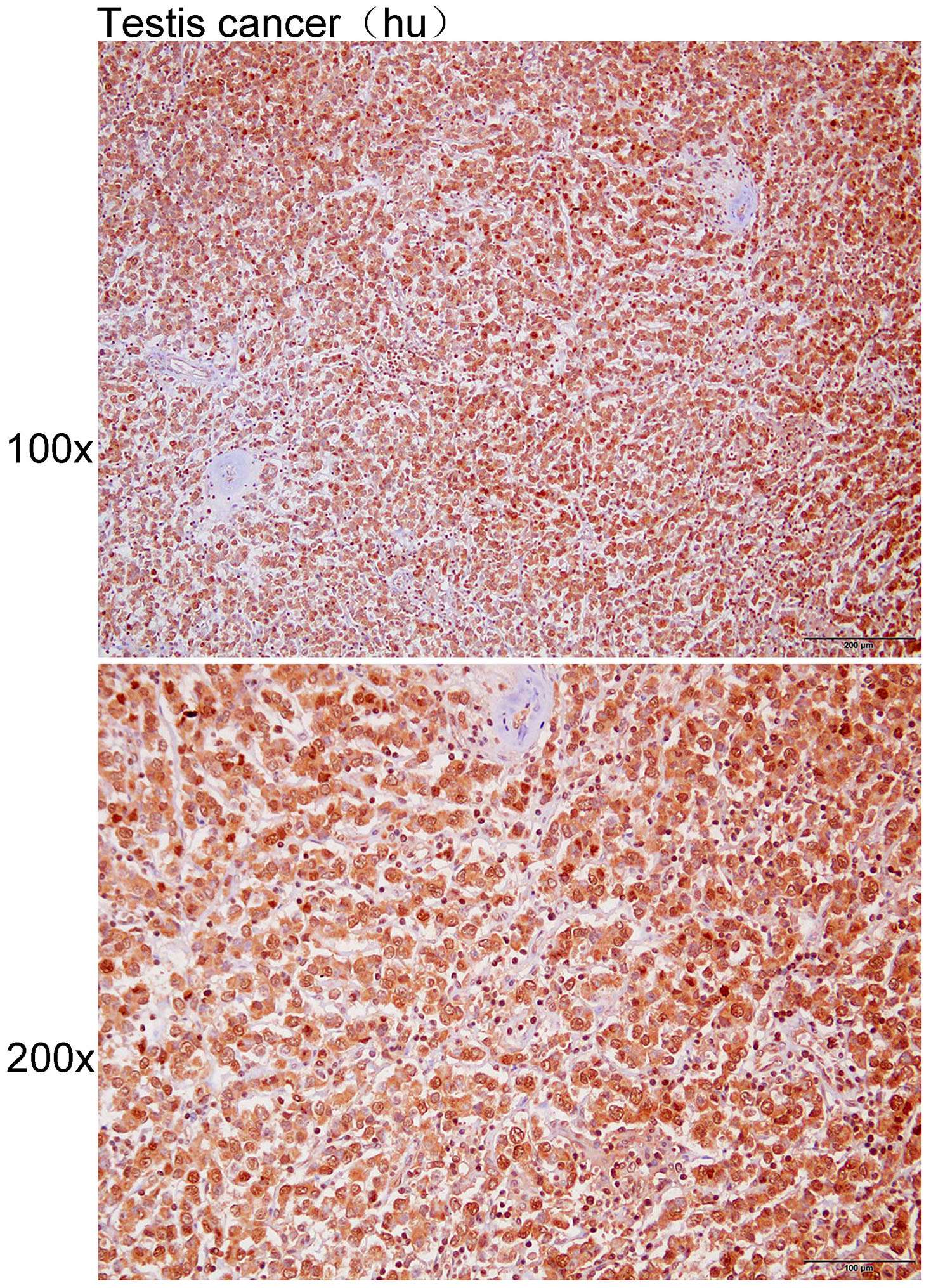 Anti-CCL4 Polyclonal Antibody
