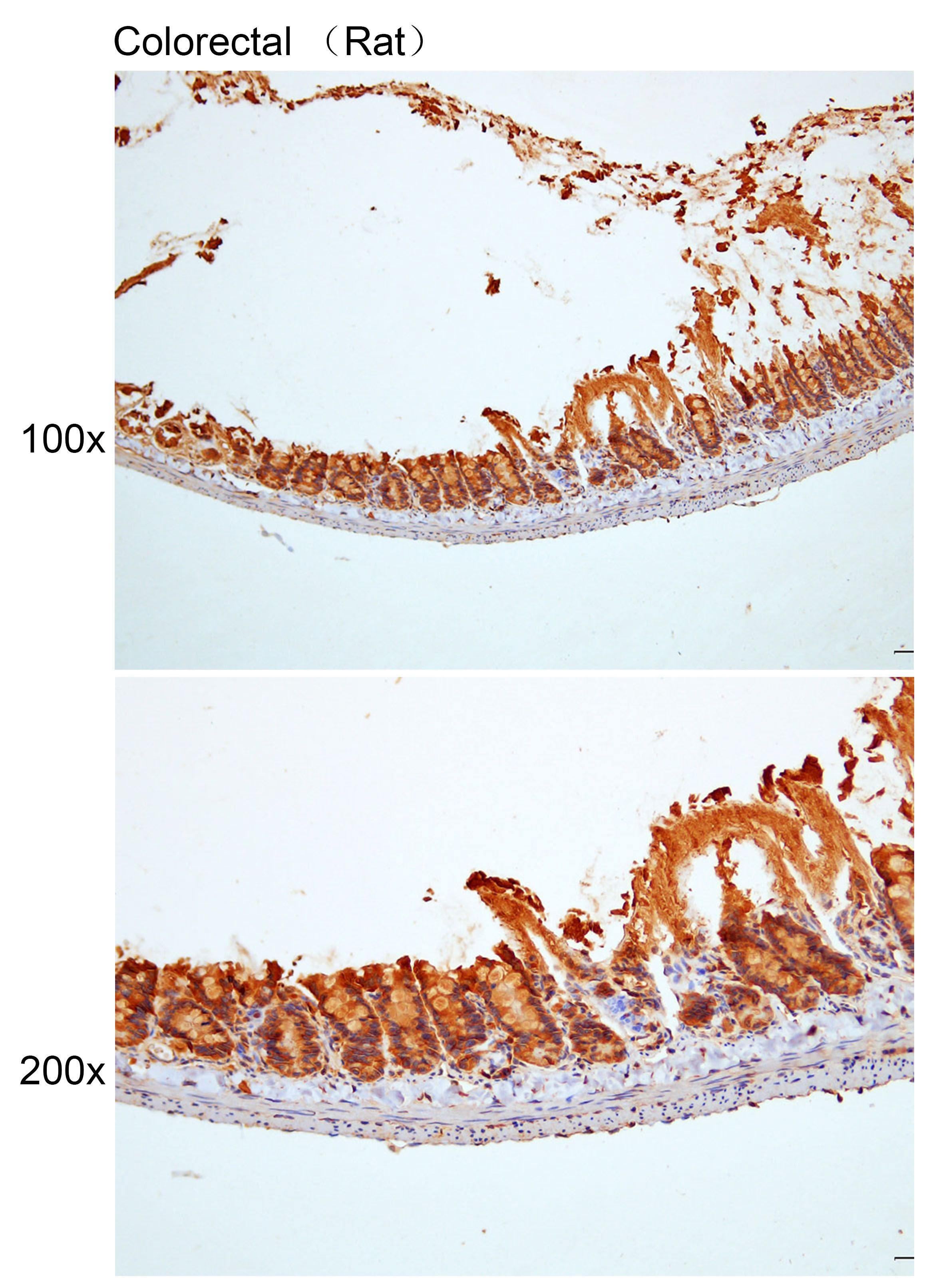 Anti-CCL4L1/CCL4 Polyclonal An