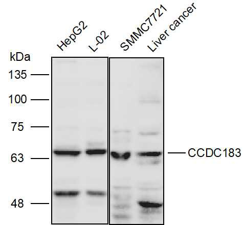 Anti-CCDC183 Polyclonal Antibo