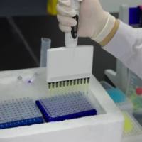 WB(蛋白质免疫印迹）