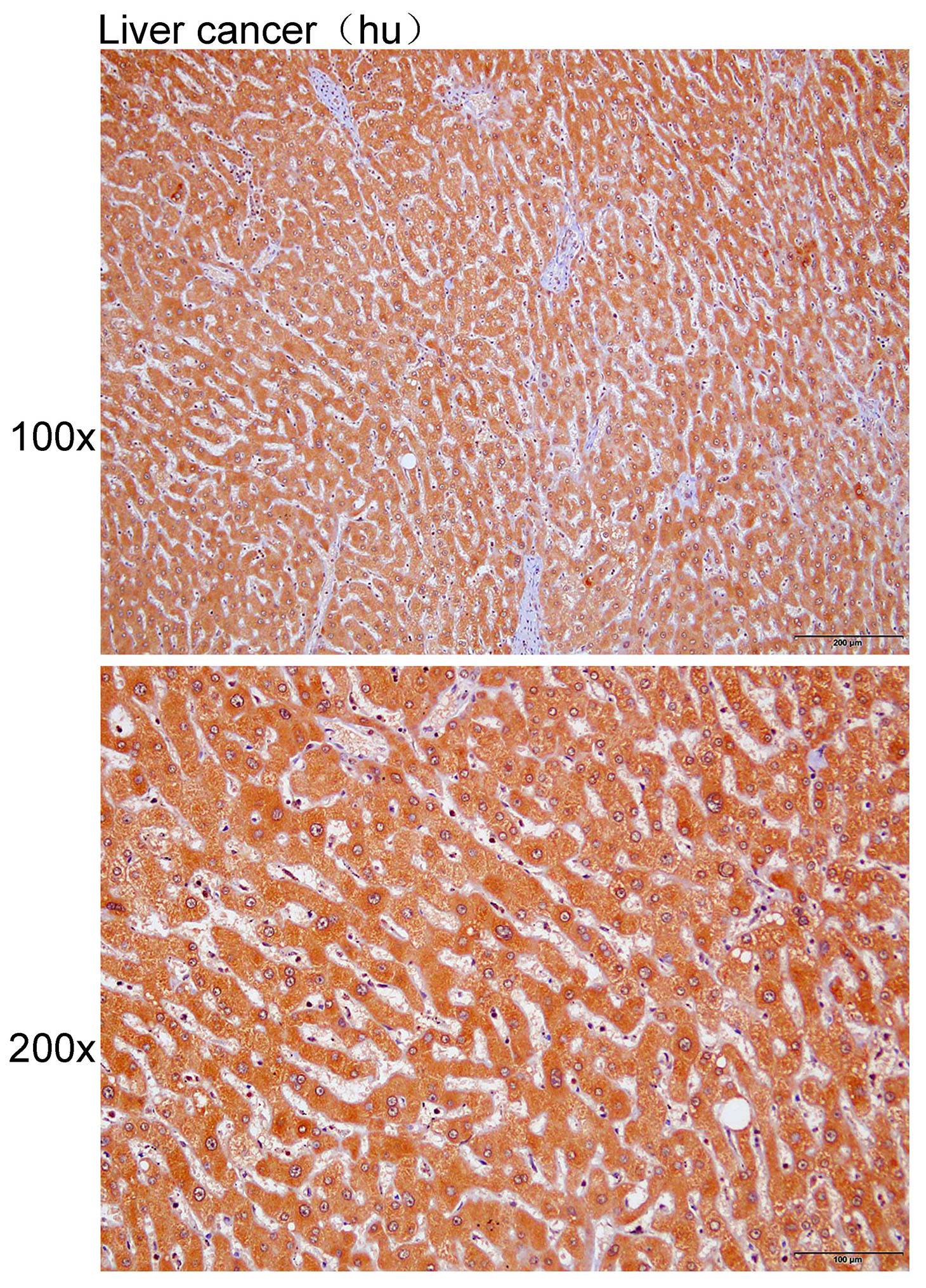 Anti-CD8B Polyclonal Antibody