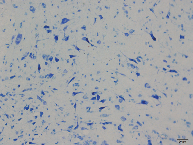 病理常规染色及特染项目