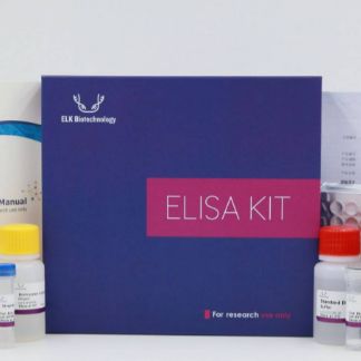 Mouse IL1β(Interleukin 1Beta)ELISA Kit