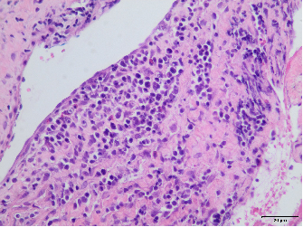 病理常规染色及特染项目
