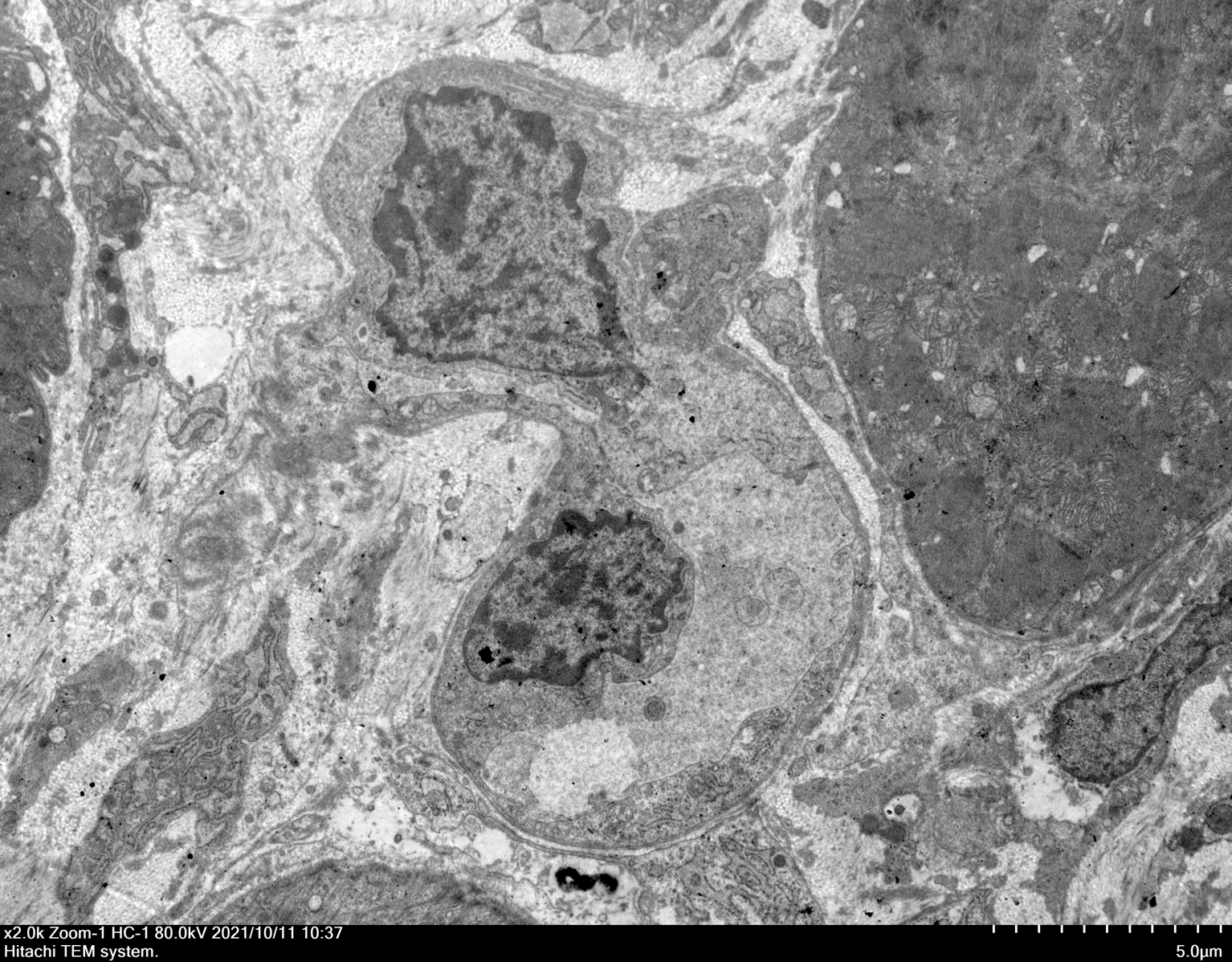 扫描电镜、透射电镜
