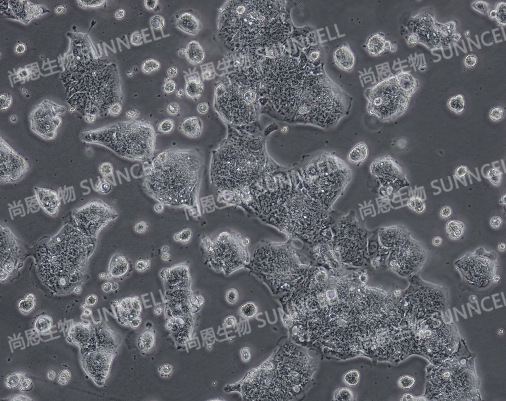细胞攻略 | T84(人结肠腺癌肺转移细胞)培养教程