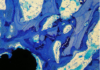 病理常规染色及特染项目