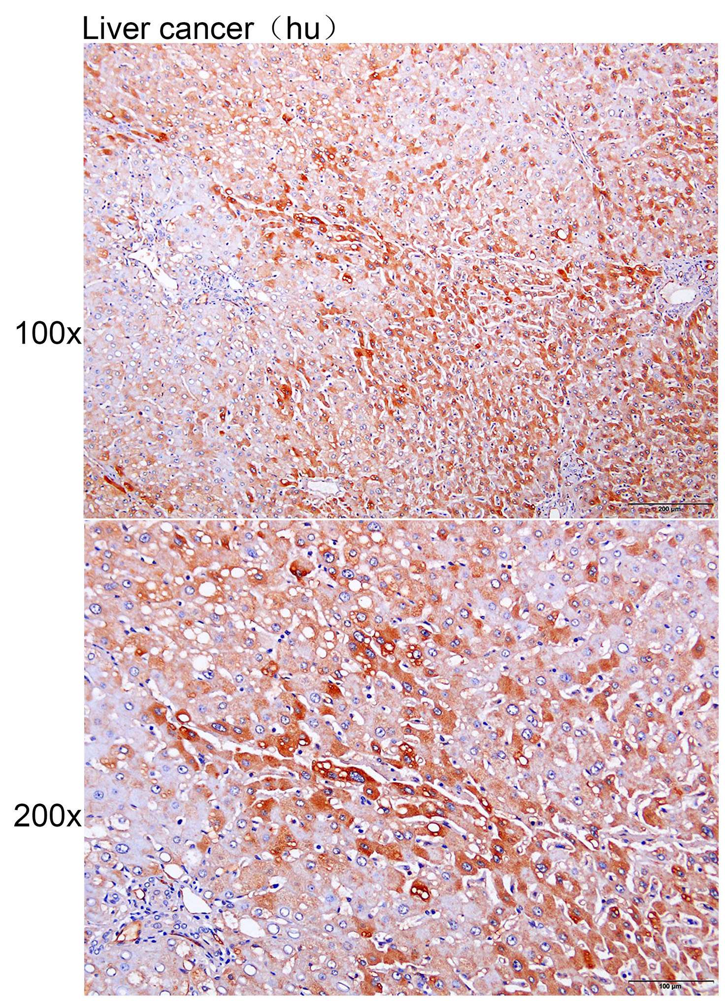 Anti-CD300LF Polyclonal Antibo