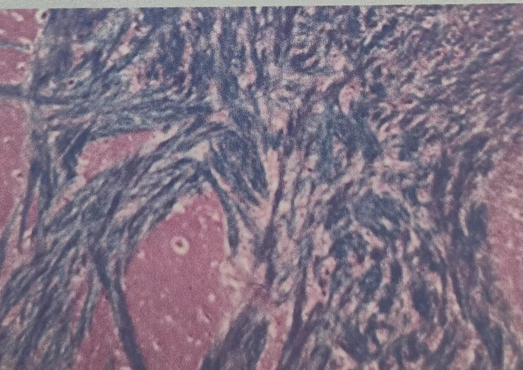 �ؽڲ���׵�����˱䡢����������ģ��