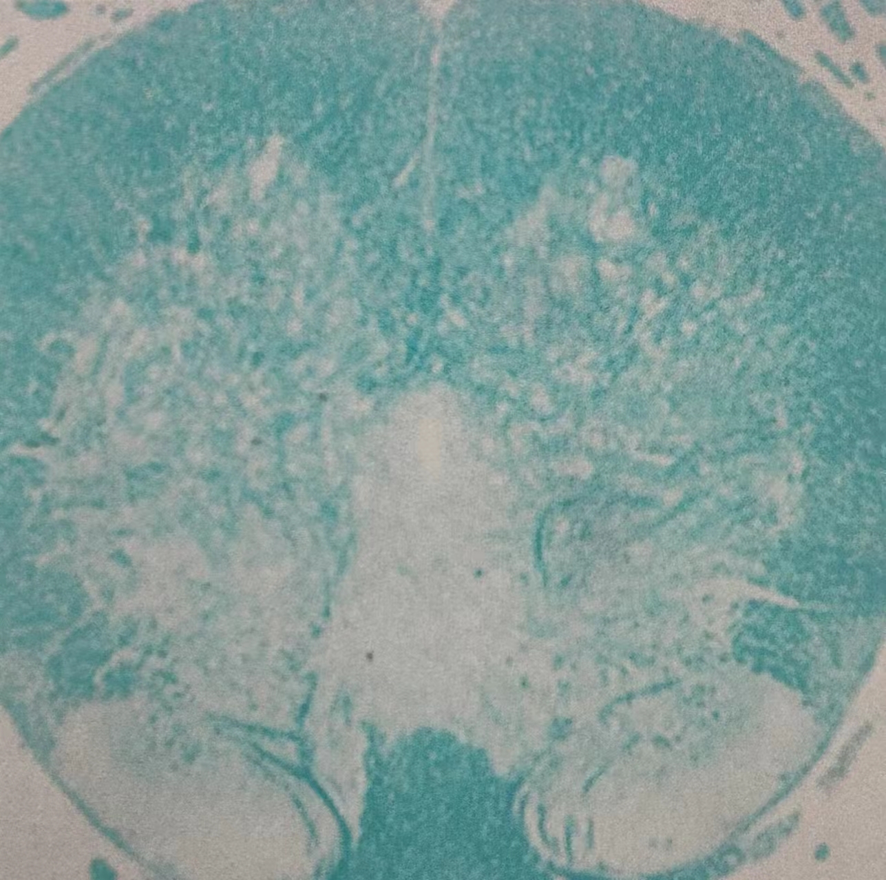 �ؽڲ���׵�����˱䡢����������ģ��