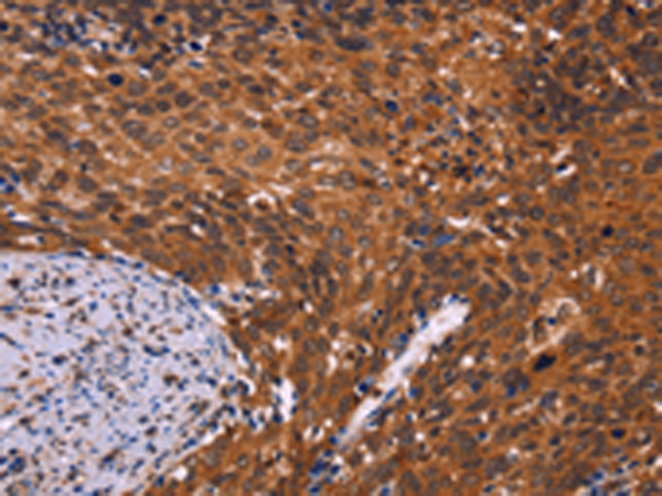 Anti-CDC5L Polyclonal Antibody