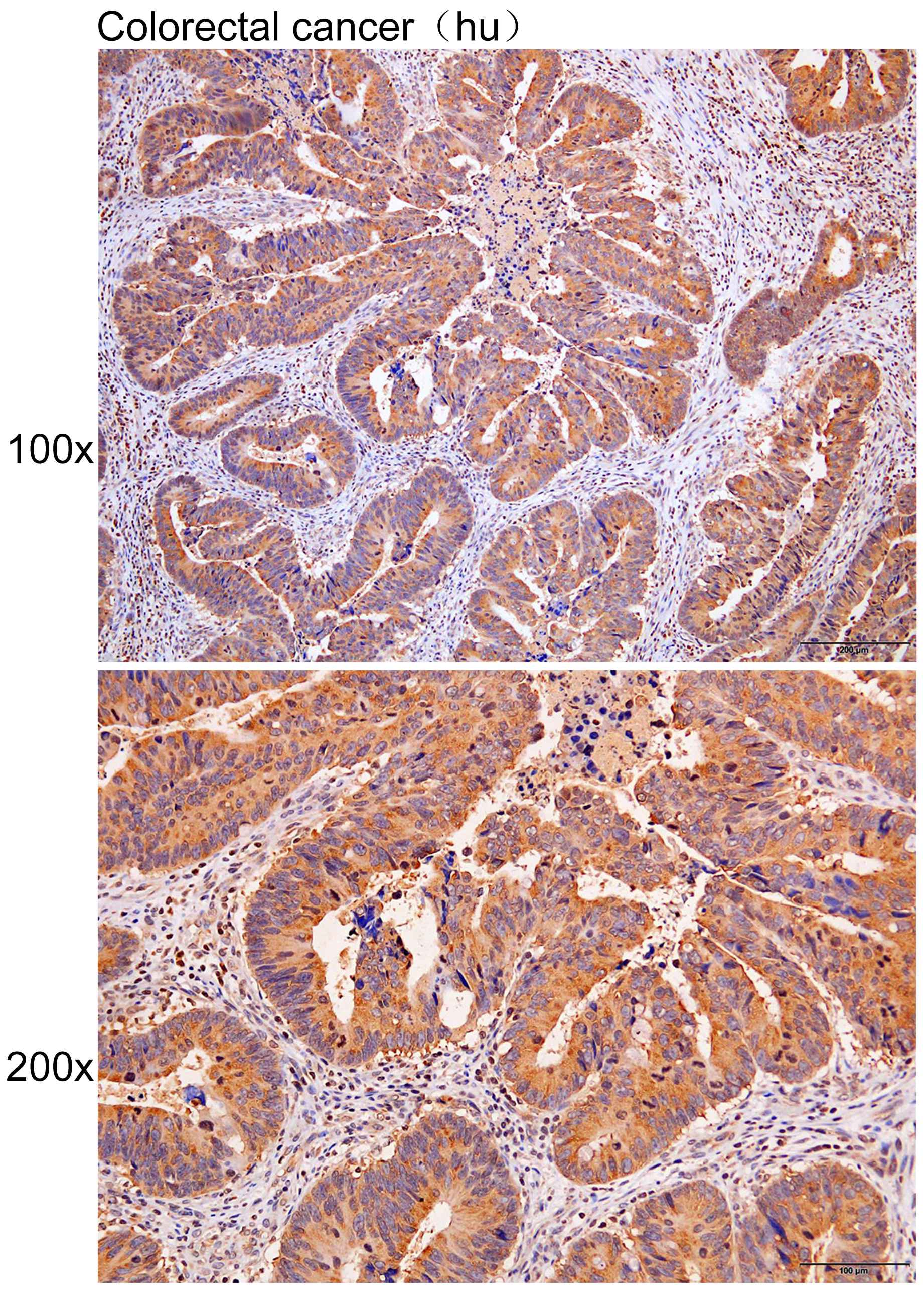 Anti-CDK18 Polyclonal Antibody