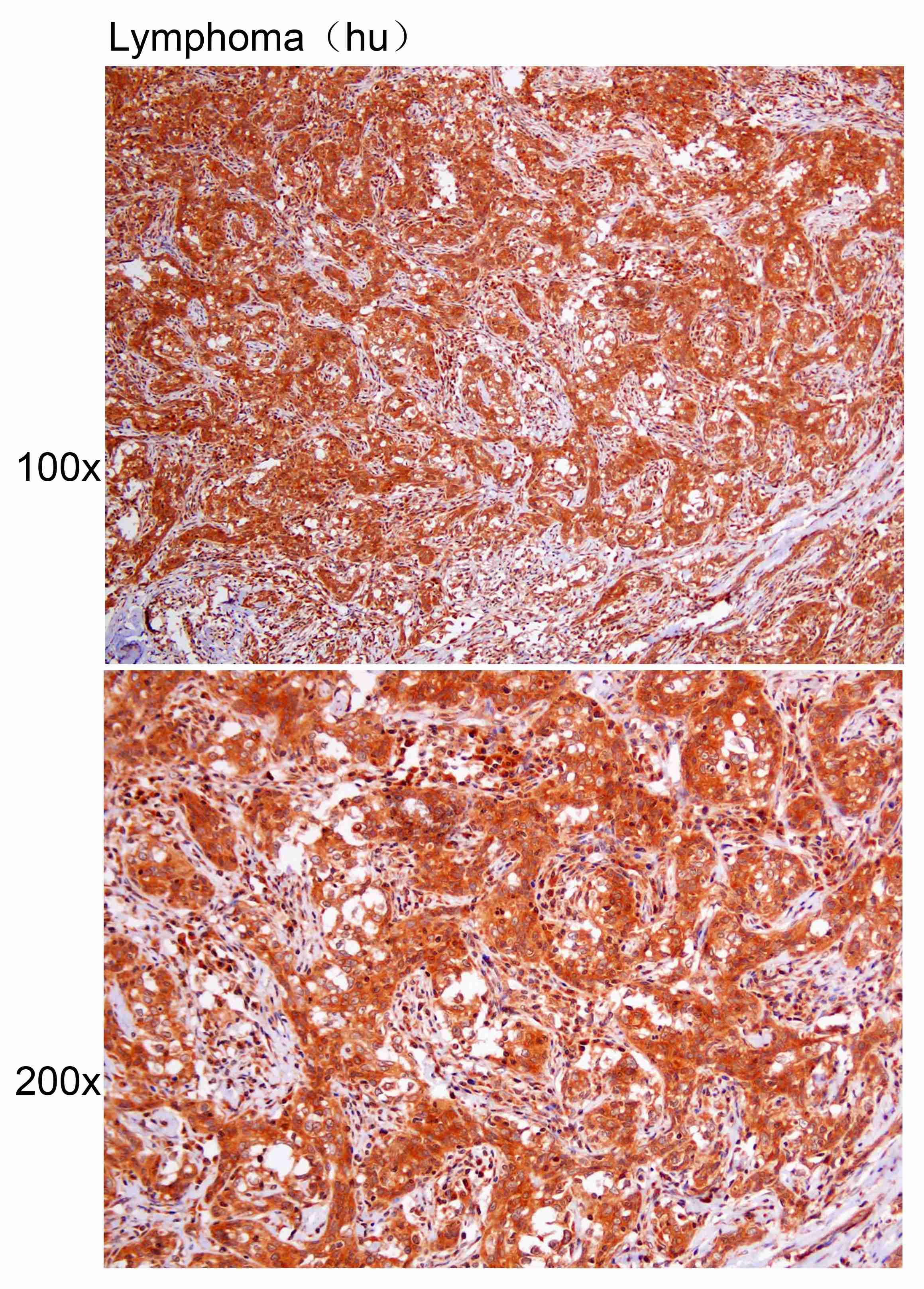 Anti-CDC25B Polyclonal Antibod