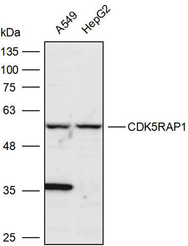 Anti-CDK5RAP1 Polyclonal Antib