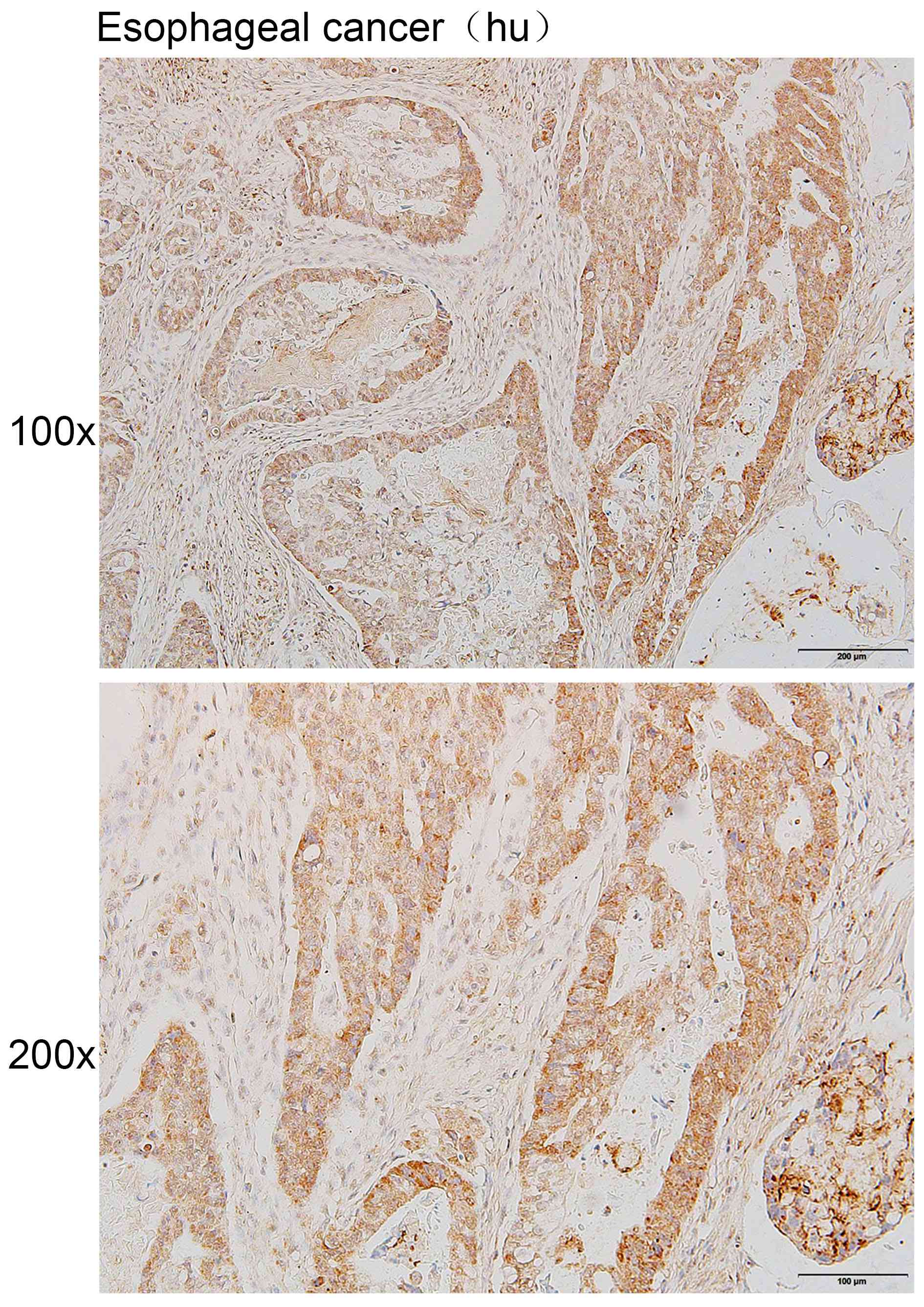 Anti-CDH13 Polyclonal Antibody