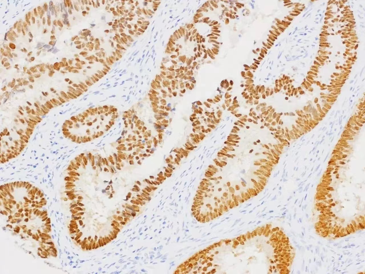 结直肠癌动物模型