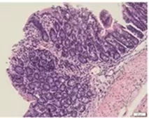 炎症性肠病动物模型