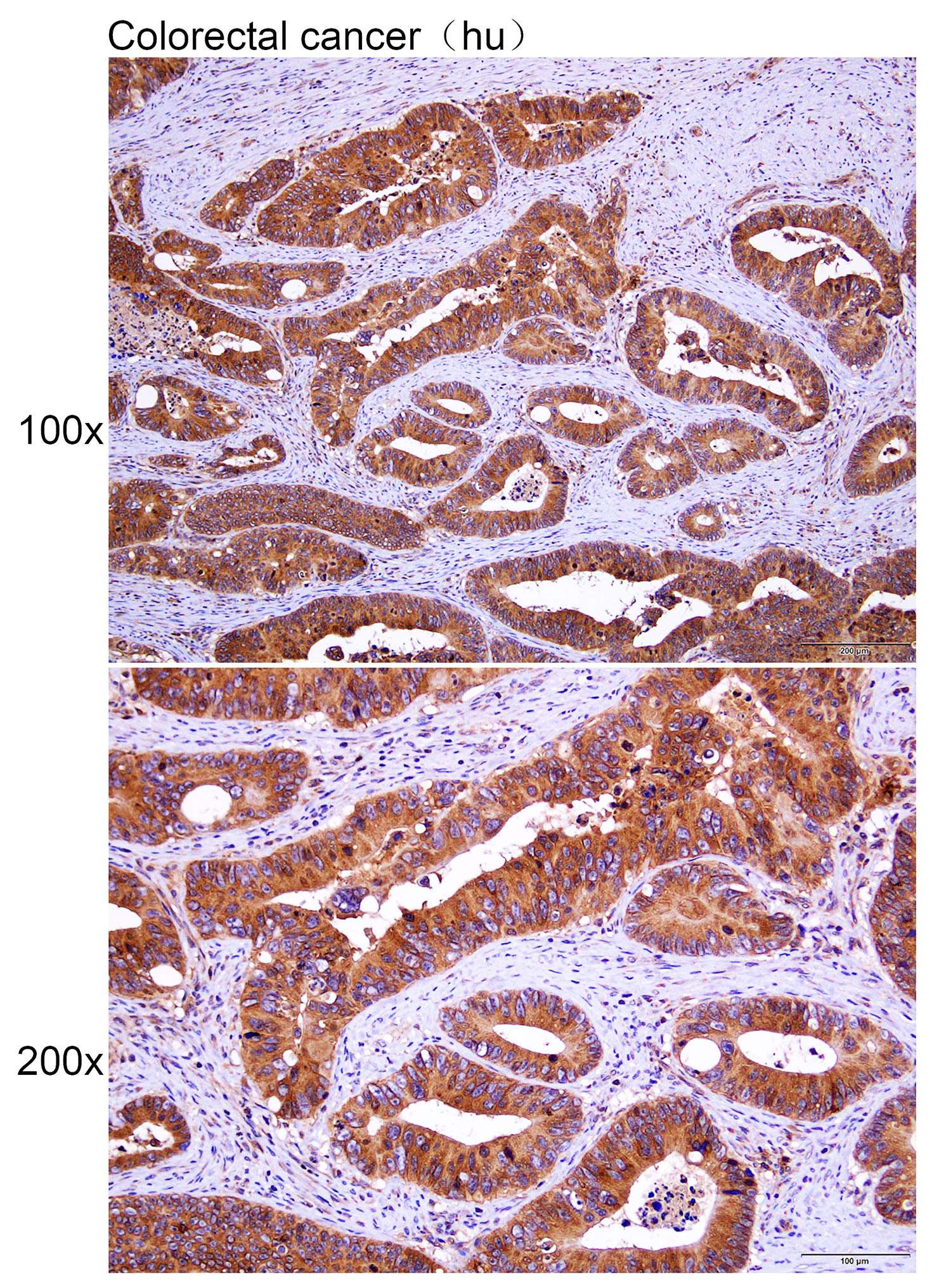 Anti-CDH17 Polyclonal Antibody