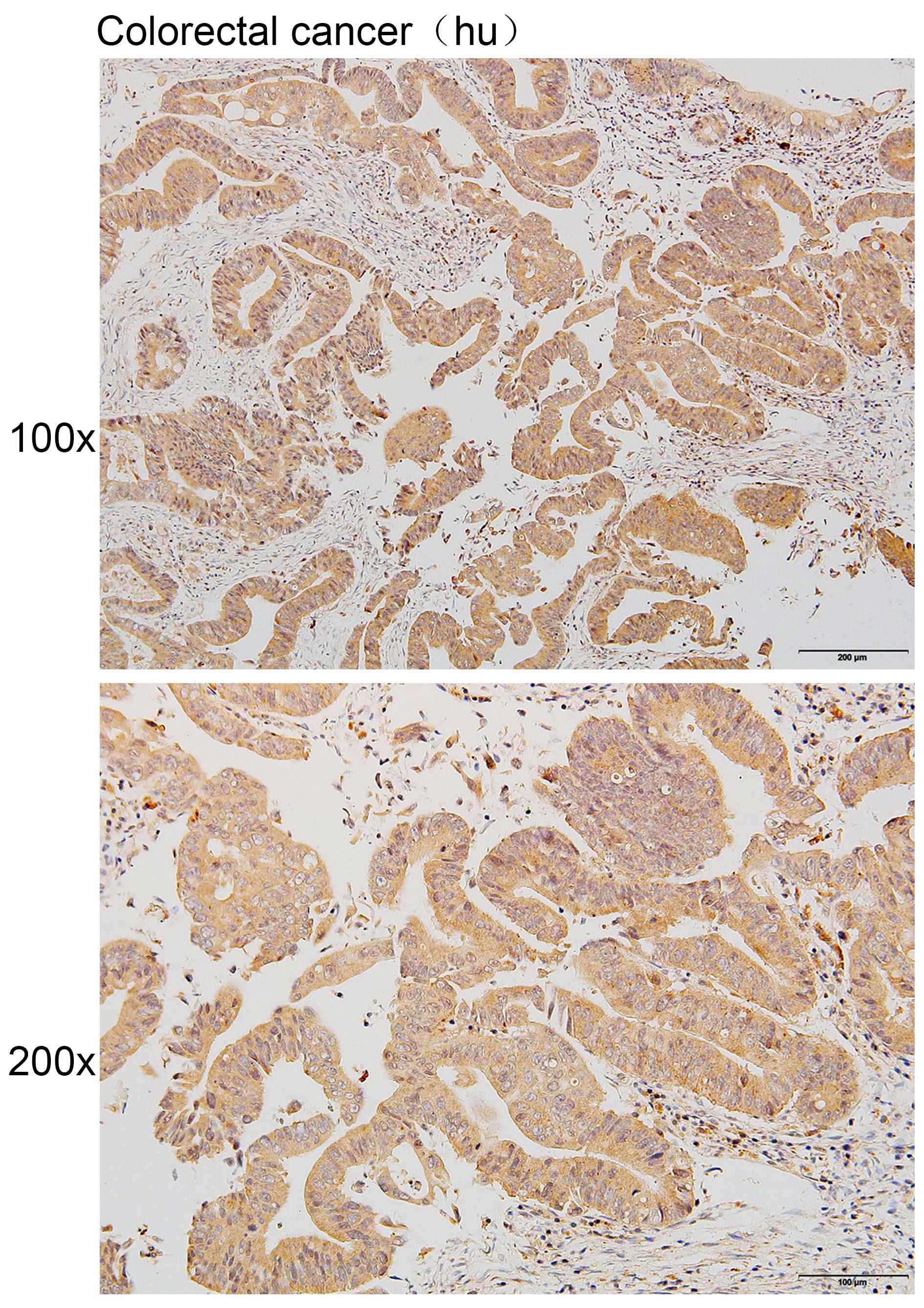 Anti-CDH5 Polyclonal Antibody