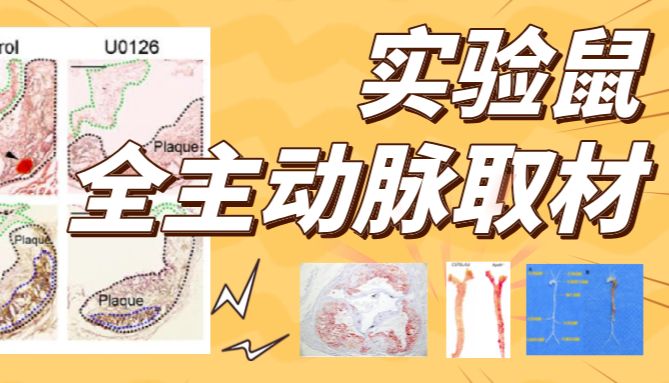听说都想学会的！实验鼠全主动脉取材