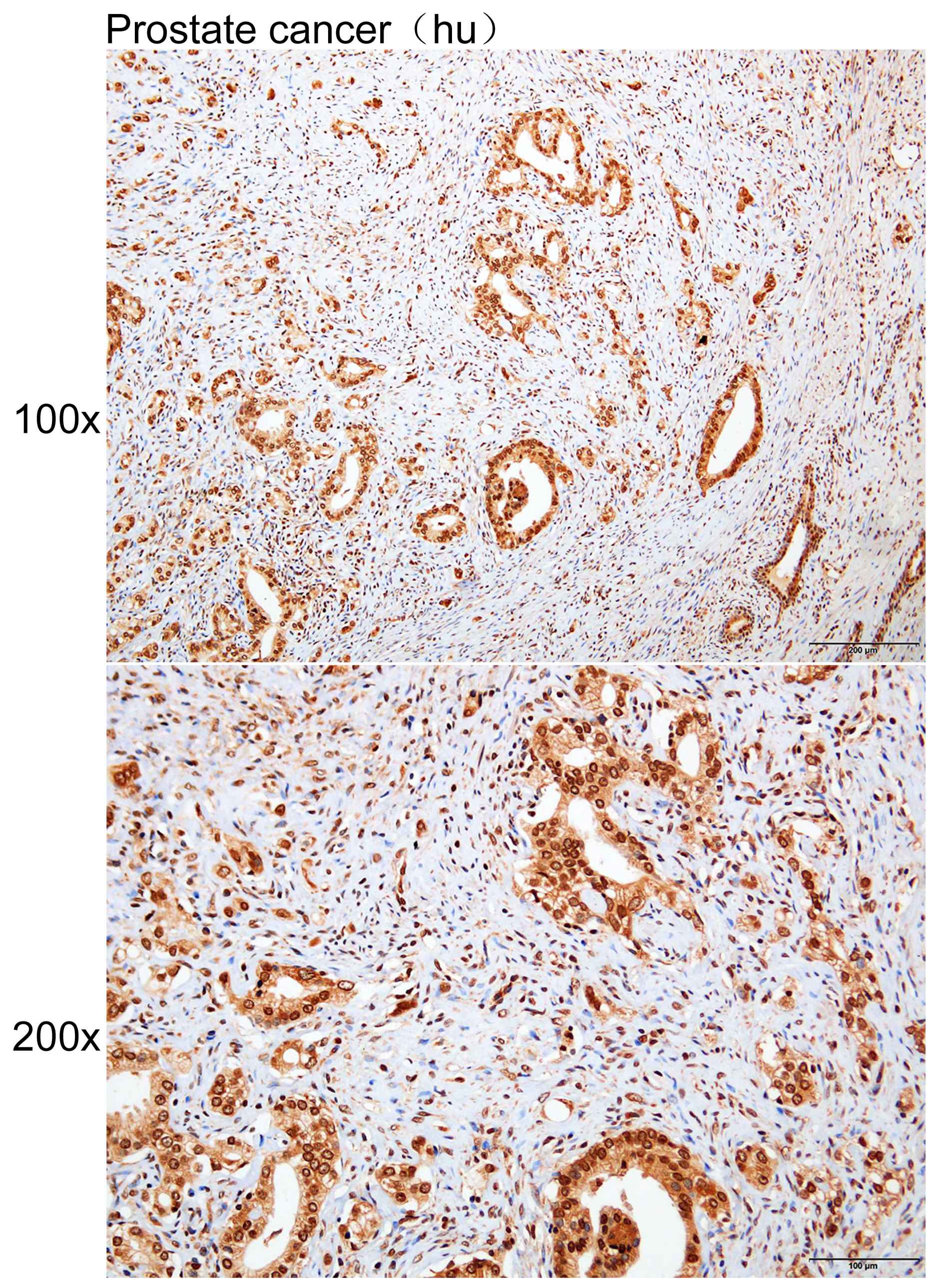 Anti-CDKN1B Polyclonal Antibod