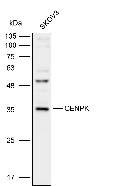 Anti-CENPK Polyclonal Antibody