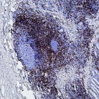 脱蜡修复二合一溶液20X pH6.0