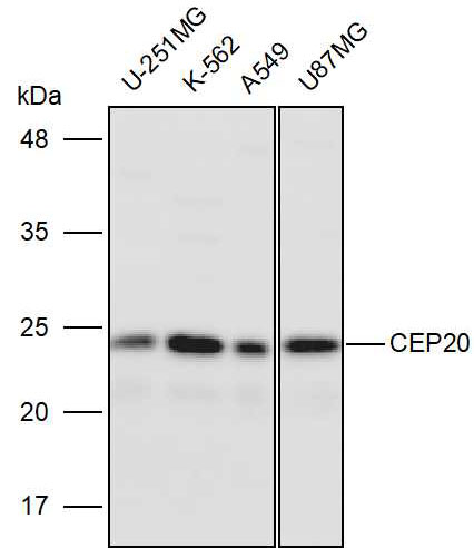 Anti-CEP20 Polyclonal Antibody