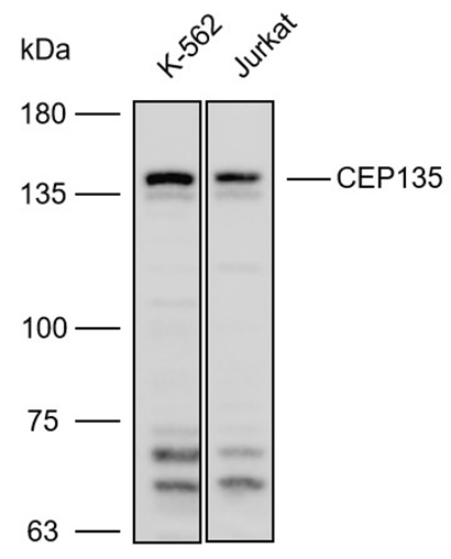Anti-CEP135 Polyclonal Antibod