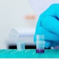 NeuroD1 Antibody FITC