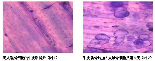 破骨细胞骨吸收功能检测方案