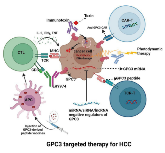 细说肝癌治疗潜力靶点--GPC3