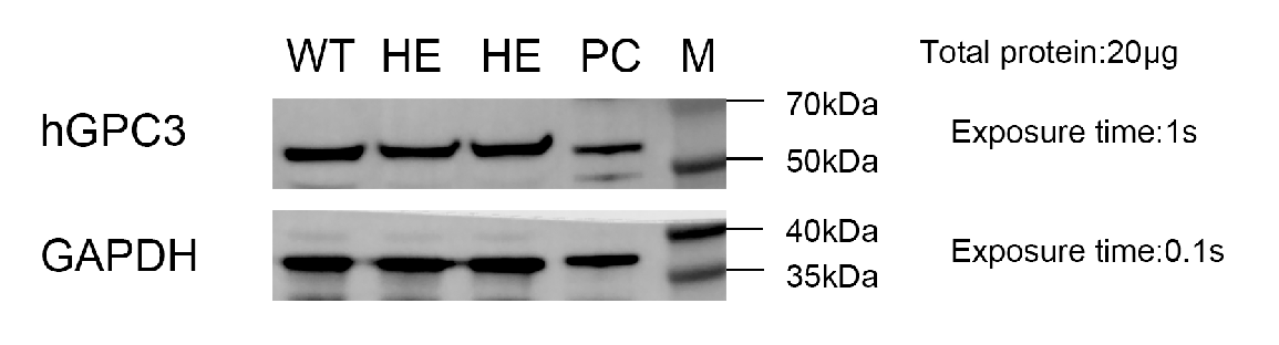 细说肝癌治疗潜力靶点--GPC3