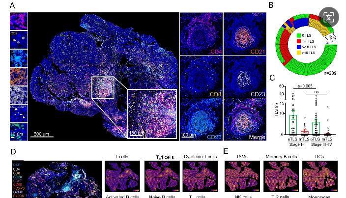 探索肿瘤微环境中的免疫堡垒：三级淋巴结构TLS的研究应用