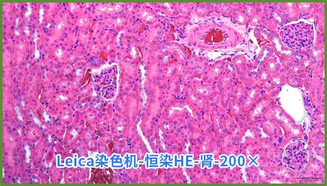 染色液|夏日大作战