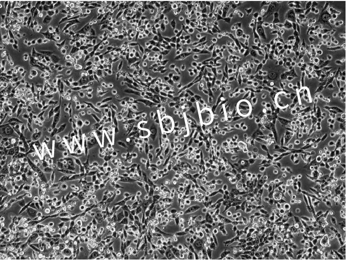 BIOCHANNEL 培养建议 | LLC小鼠Lewis肺癌细胞