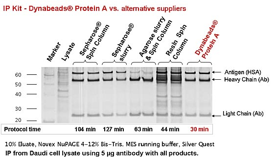 揭穿免疫沉淀“四大误解” Dynabeads磁珠让免疫沉淀实验事半功倍