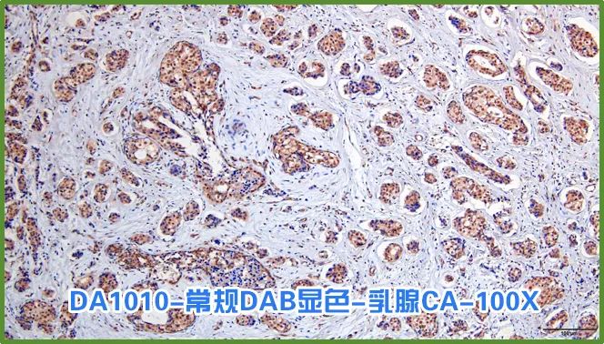 染色液|夏日大作战