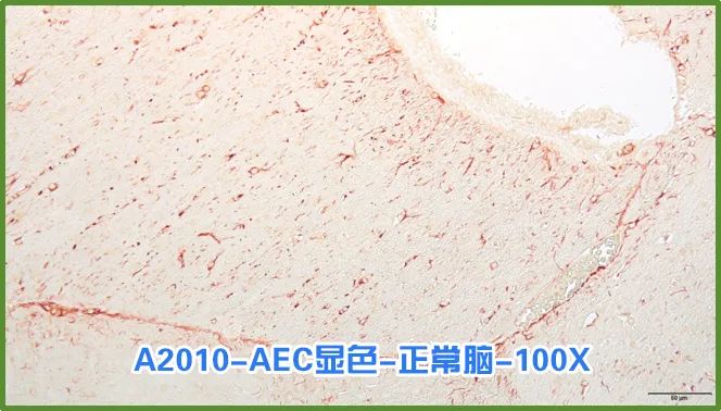 染色液|夏日大作战