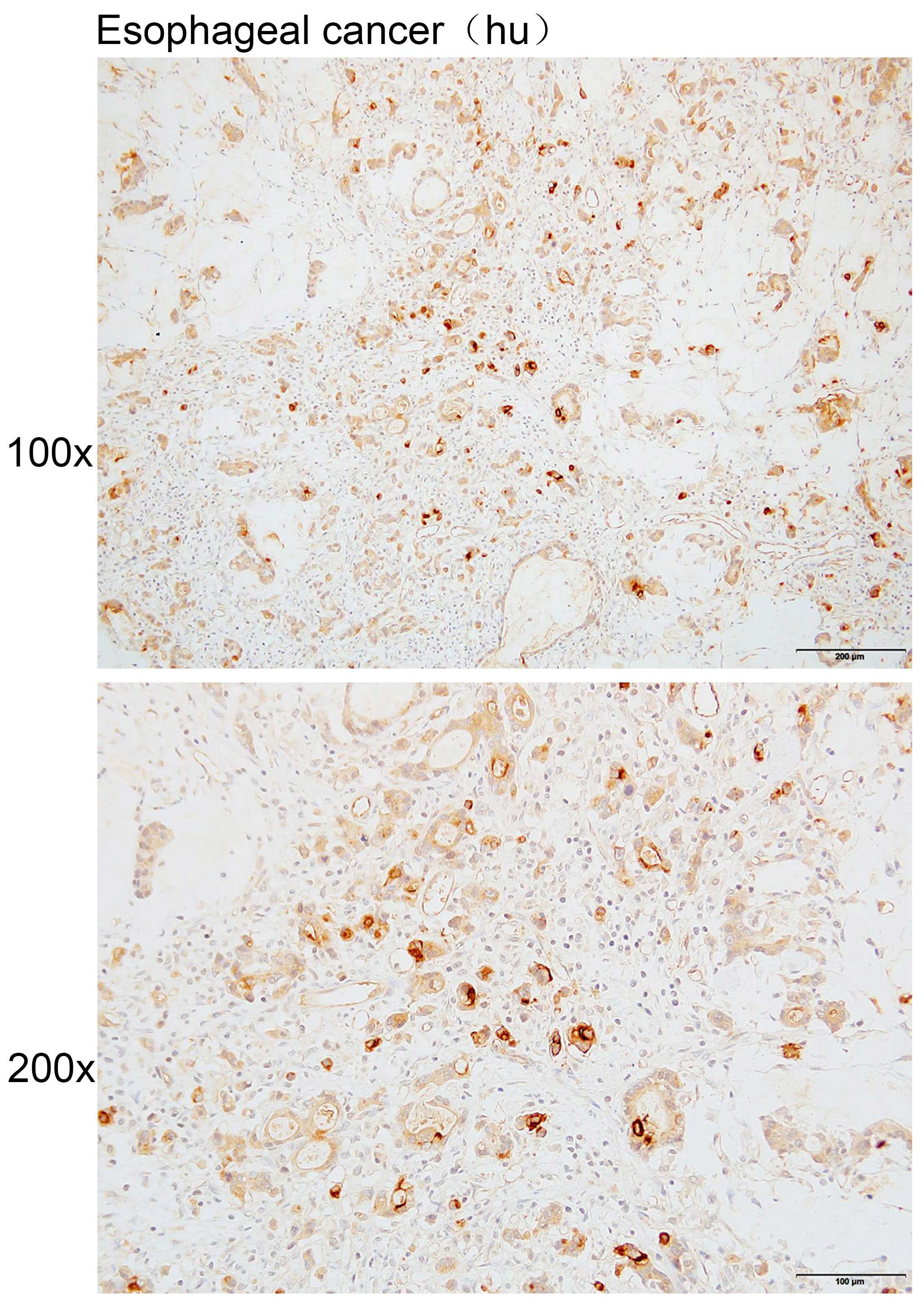 Anti-Clca4a Polyclonal Antibod