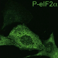 匈牙利Scicons 抗dsRNA单克隆抗体