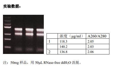 柱式法提取植物RNA试剂盒