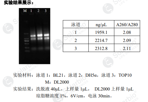 磁珠法提取细菌RNA试剂盒