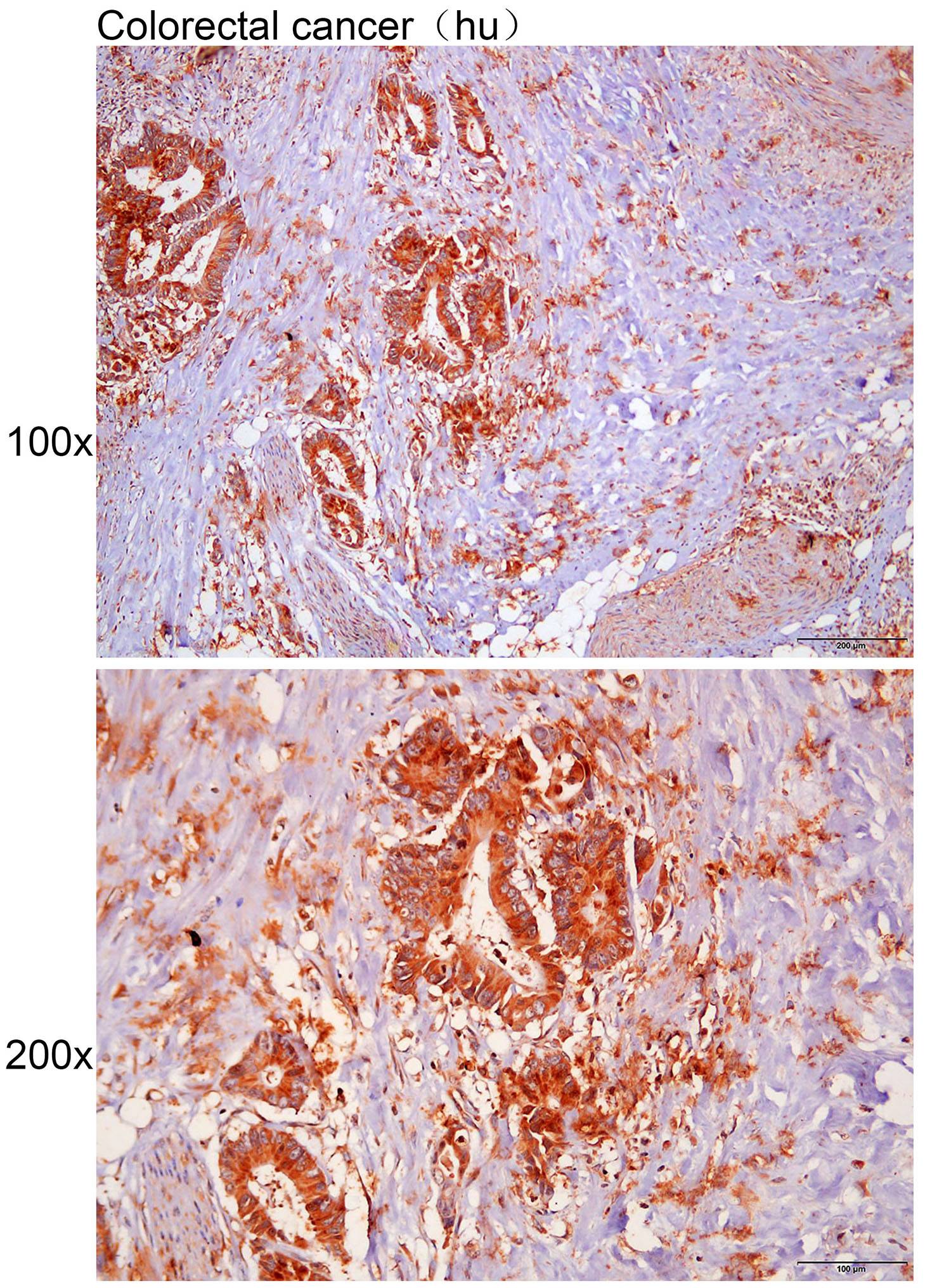 Anti-CLDN8 Polyclonal Antibody