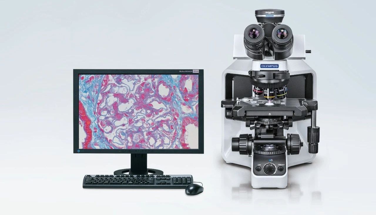 新品发布│E慧眼智能显微镜驱动中国数字病理市场变革