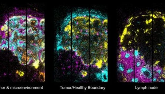 表观快讯 | 空间转录组学平台有望实现低成本、高分辨率三维绘图
