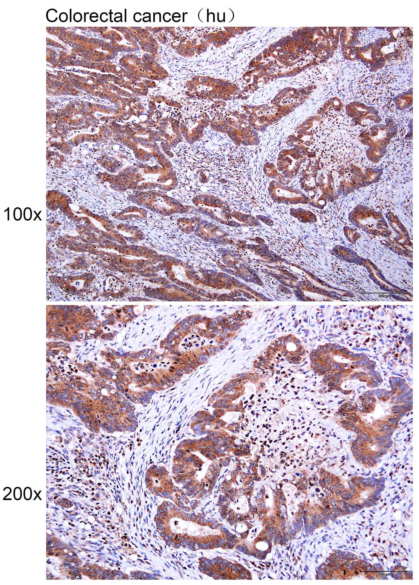 Anti-CLNS1A Polyclonal Antibod