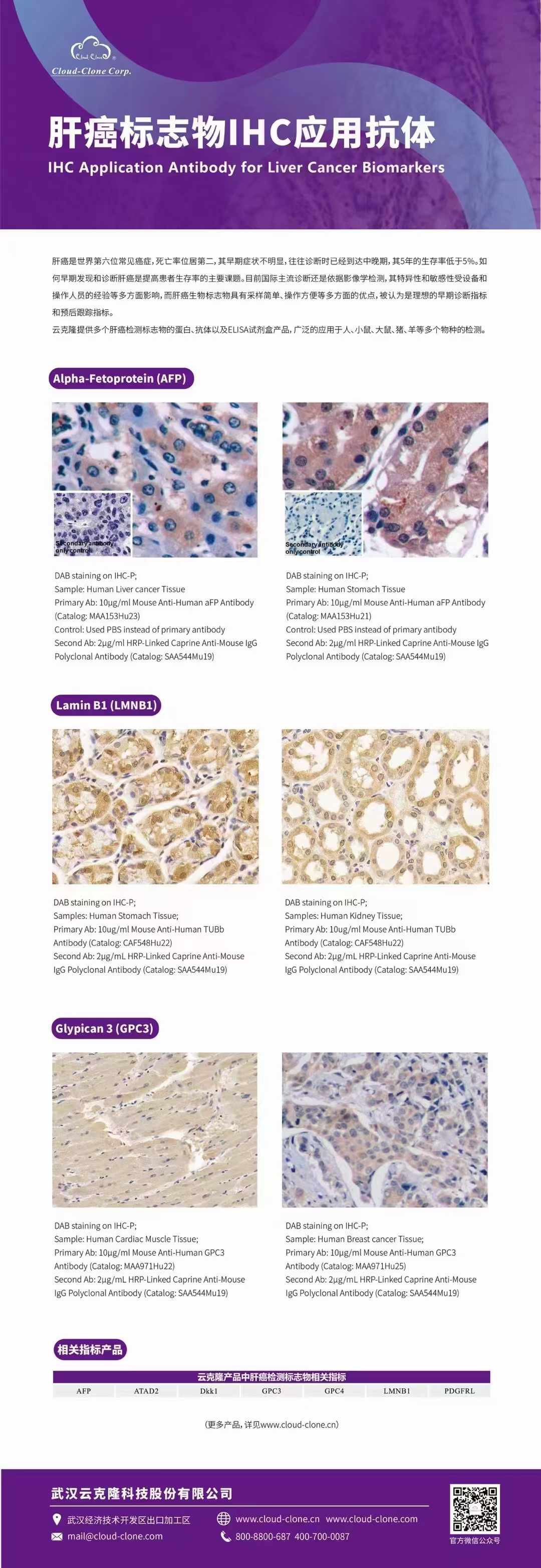 肝癌标志物-IHC应用—Cloud-Clone之经典抗体