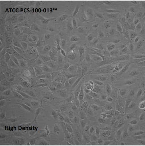 人正常原代脐静脉内皮细胞，混合来源（HUVEC）